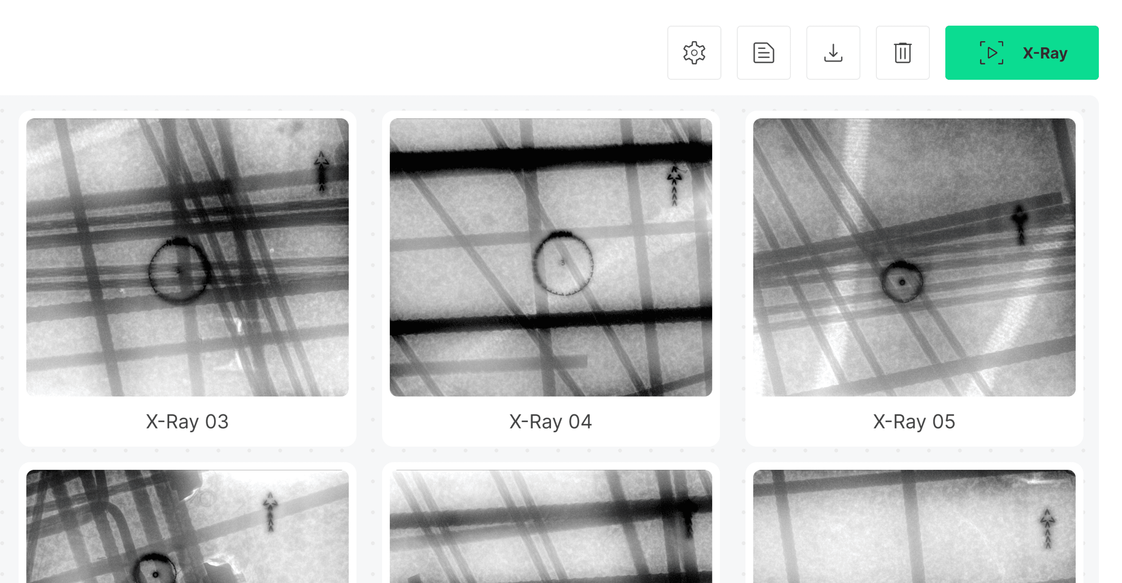 Radii-x Digital X-Ray Software
